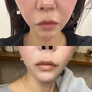 ルラ美容クリニック ルラ美容クリニック 千葉院 / ルラスキンクリニック 千葉院口コミ