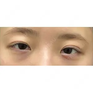 渋谷の森クリニック口コミ