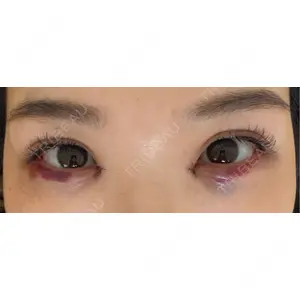 HAAB×DREAM BEAUTY CLINIC HAAB×DREAM BEAUTY CLINIC 大阪梅田院口コミ