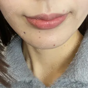 口コミ
