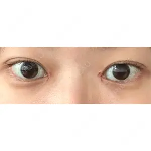 東京シンデレラ美容外科 東京シンデレラ美容外科 池袋院口コミ