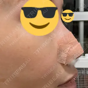 銀座マイアミ美容外科口コミ