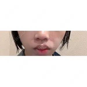 口コミ