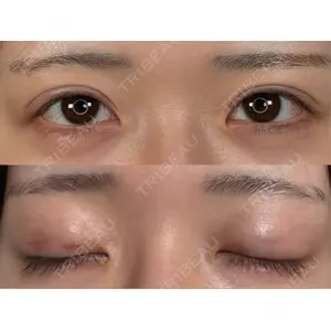 アリエル美容クリニック アリエル美容クリニック 大宮院口コミ