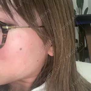 おおかみ美容のクリニックの口コミ