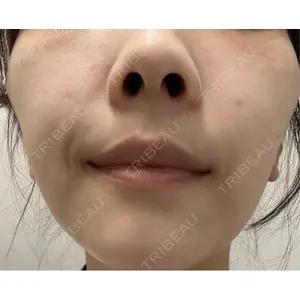 L‘amour clinic Tokyo【ラムールクリニック東京】口コミ