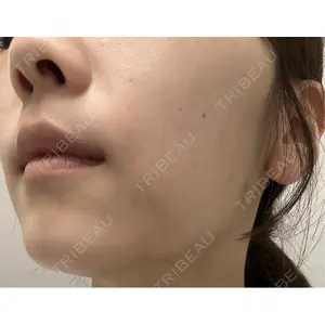 L‘amour clinic Tokyo【ラムールクリニック東京】口コミ