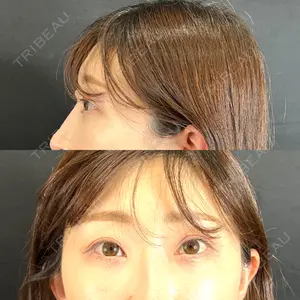 藤・ナチュレ美容クリニック 藤・ナチュレ美容クリニック 銀座院口コミ