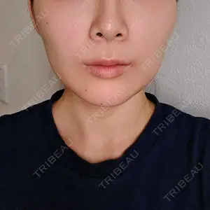 藤・ナチュレ美容クリニック 藤・ナチュレ美容クリニック 銀座院口コミ