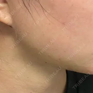ルラ美容クリニック ルラ美容クリニック 大阪本院口コミ
