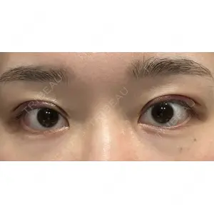 LUHO（ルホ）美容外科口コミ
