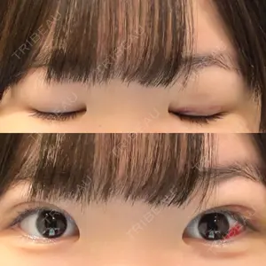湘南美容クリニック 湘南美容クリニック 千葉センシティ院口コミ