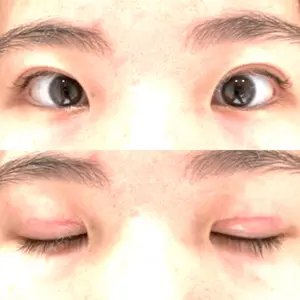 東京BELLEZZAクリニック口コミ