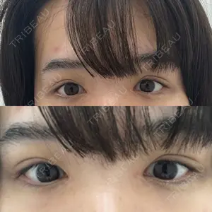 プライベートスキンクリニック 梅田本院口コミ