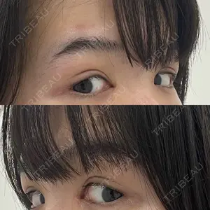 プライベートスキンクリニック 梅田本院口コミ