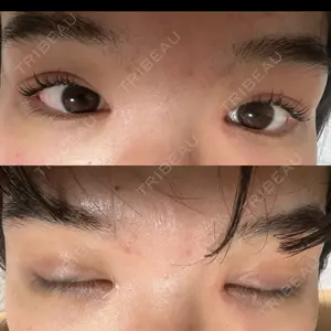 プライベートスキンクリニック 梅田本院口コミ