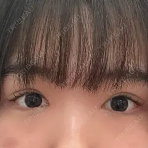 プライベートスキンクリニック 梅田本院口コミ