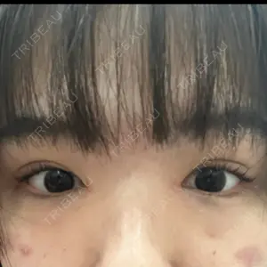 プライベートスキンクリニック 梅田本院口コミ