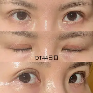 BIANCA CLINIC BIANCA銀座口コミ