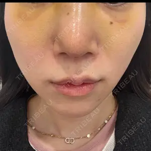 口コミ