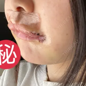 口コミ
