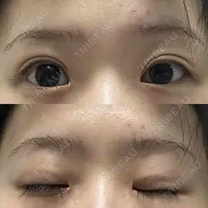 R.O.clinic口コミ