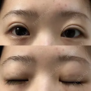 R.O.clinic口コミ
