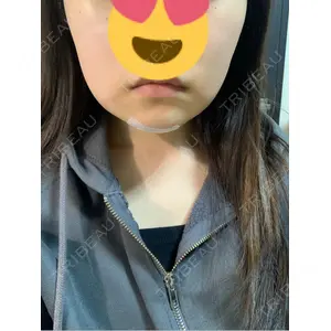 AVAN TOKYO 銀座脂肪吸引 クリニックの