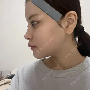 口コミ