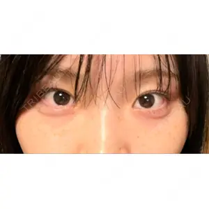 口コミ