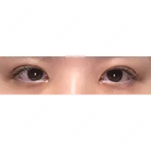 口コミ