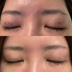 9BeautyClinic口コミ