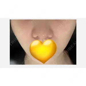 LUHO（ルホ）美容外科口コミ