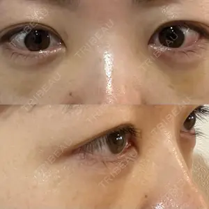 藤・ナチュレ美容クリニック 藤・ナチュレ美容クリニック 銀座院口コミ