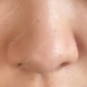 渋谷美容外科クリニックの口コミ