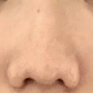 口コミ