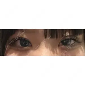 口コミ