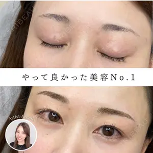 APスキンクリニック銀座口コミ