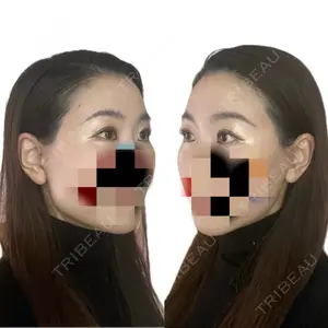 口コミ