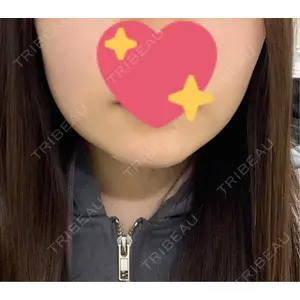 AVAN TOKYO 銀座脂肪吸引 クリニックの