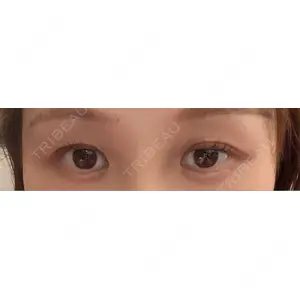 東京シンデレラ美容外科 東京シンデレラ美容外科 大宮院口コミ