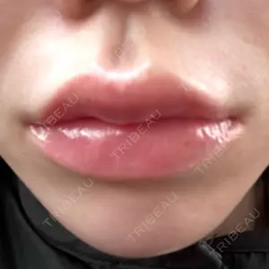 ルラ美容クリニック ルラ美容クリニック 名古屋本院口コミ