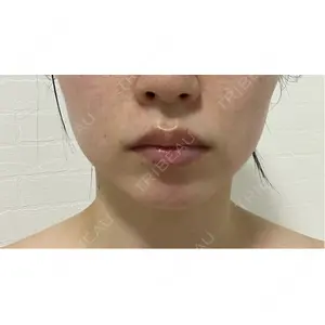 フォンタナクリニック天神口コミ