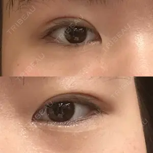 アリエル美容クリニック アリエル美容クリニック 大宮院口コミ