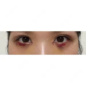HAAB×DREAM BEAUTY CLINIC HAAB×DREAM BEAUTY CLINIC 大阪梅田院口コミ