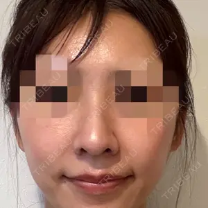 口コミ