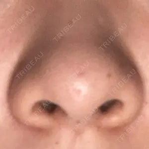 渋谷美容外科クリニックの口コミ