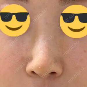 銀座マイアミ美容外科口コミ