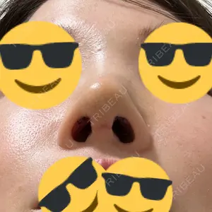 銀座マイアミ美容外科口コミ