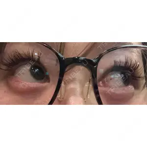 口コミ